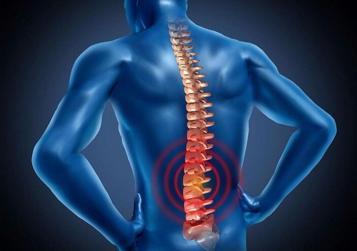 osteocondroza de gradul I al lombului